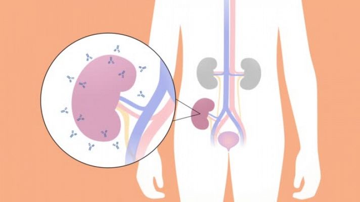  - Grafisme del procediment del trasplantament pediàtric