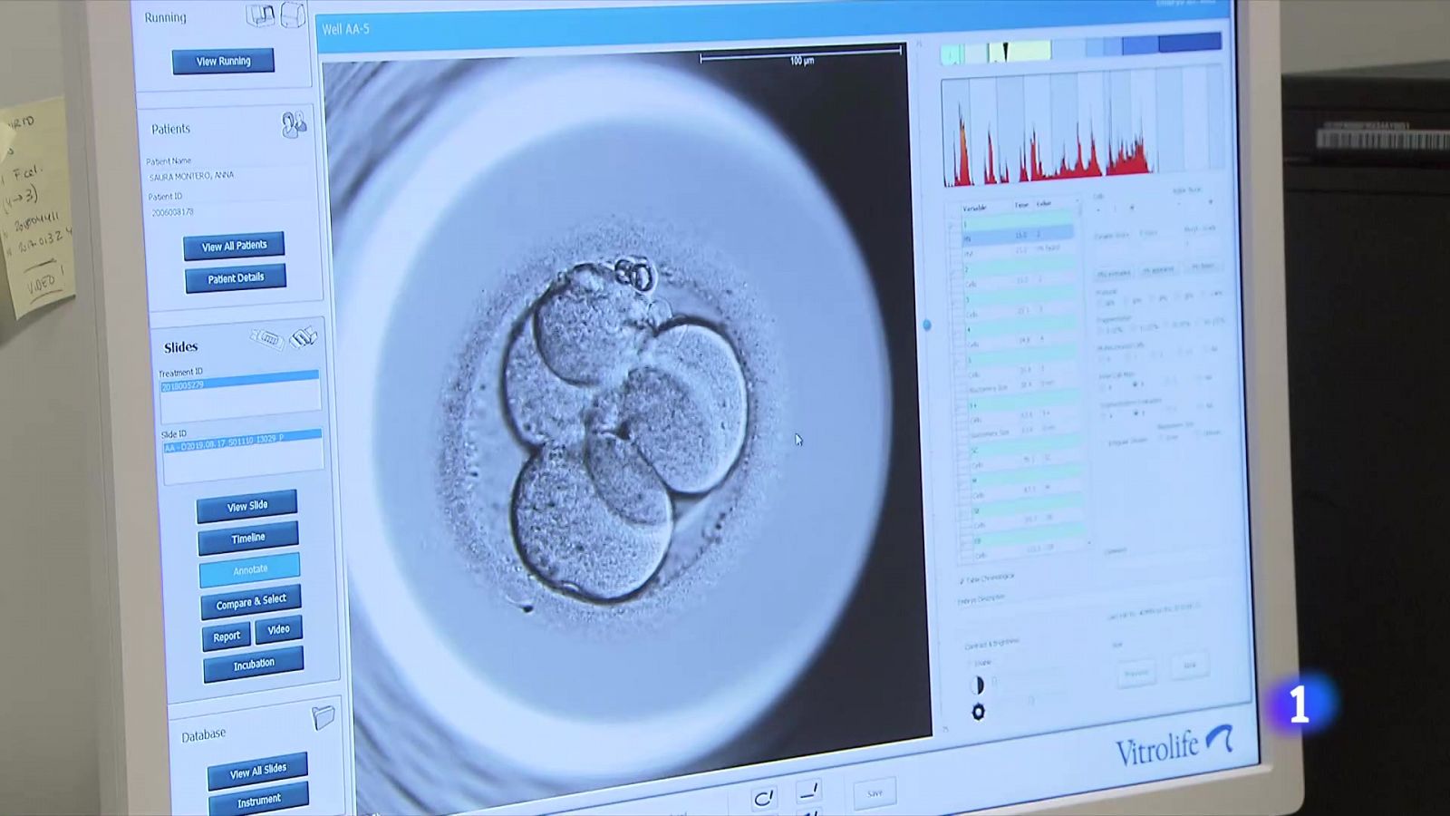 Científicos incorporan células humanas en embriones de mono