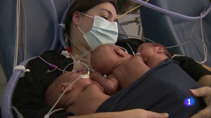 L'Informatiu - Vall d'Hebron aconsegueix que una mare faci mètode cangur amb els seus trigèmins prematurs