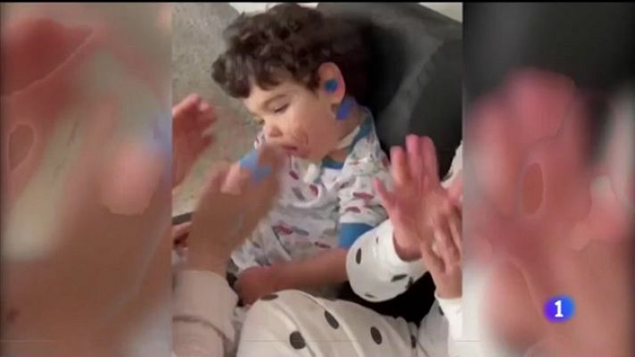 Telexornal - Galicia - Peixe cebra para curar enfermidades raras