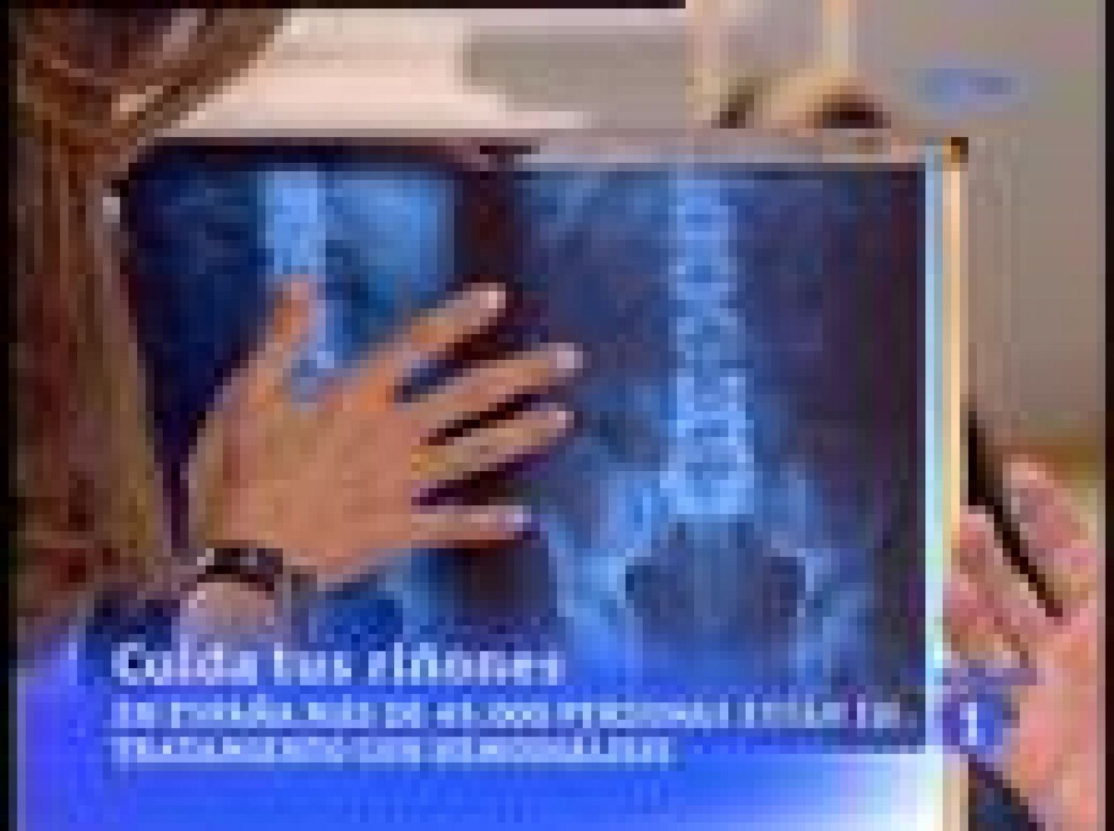 La mañana: Cuida los riñones | RTVE Play