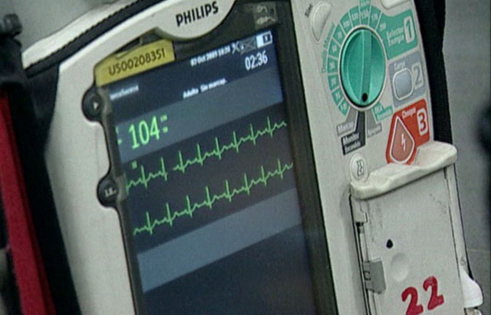 Hasta quince genes están implicados en la muerte súbita - Ciencia y tecnología en Rtve.es | Ver