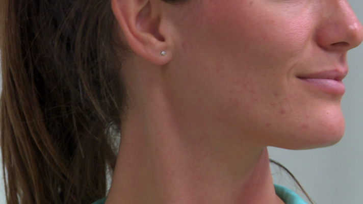 Saber vivir - Cómo podemos aliviar la tensión en el cuello y la cara