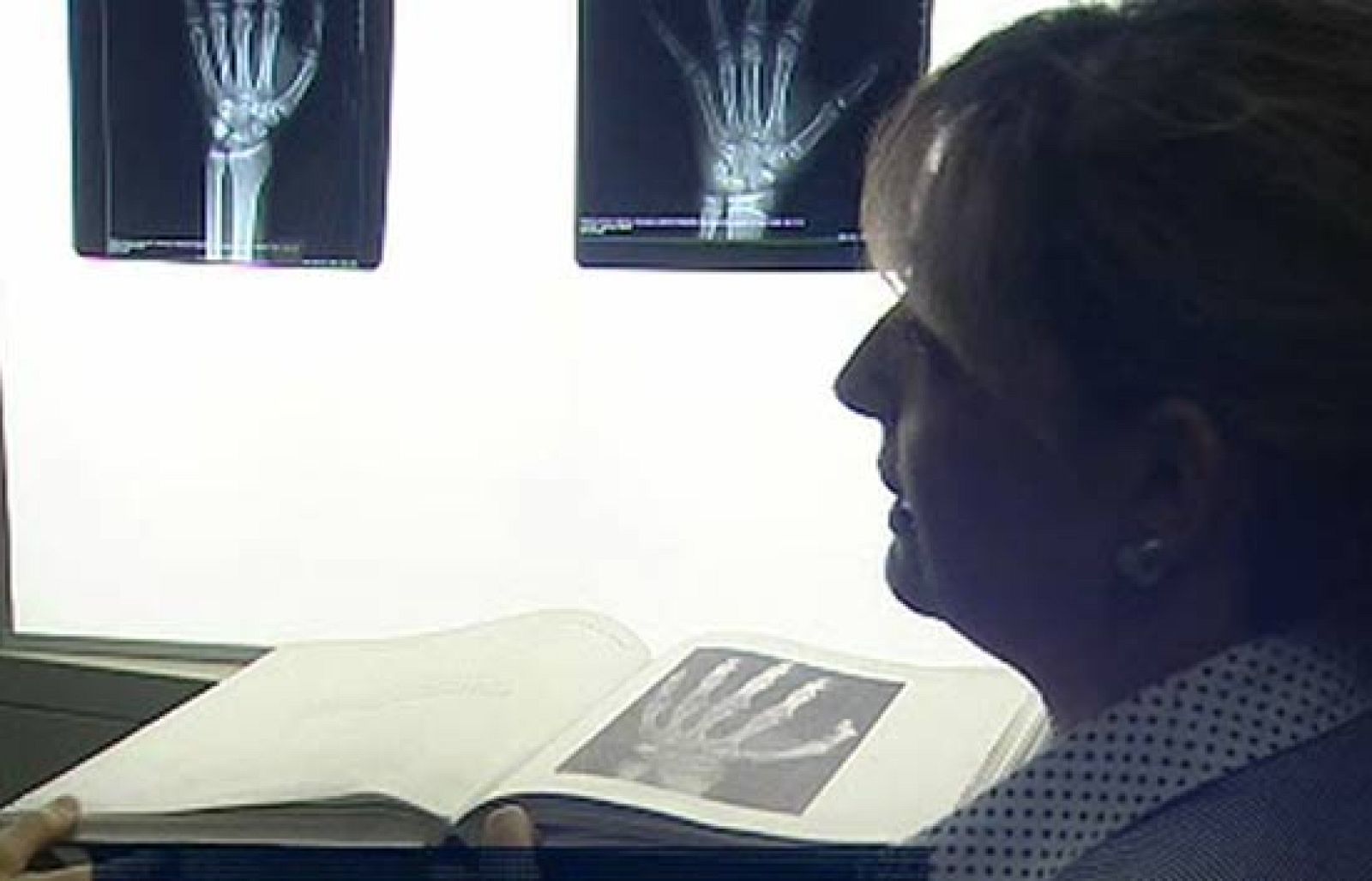 ¿Cómo averigua un forense la edad de una persona? - Ciencia y tecnología en Rtve.es | Ver