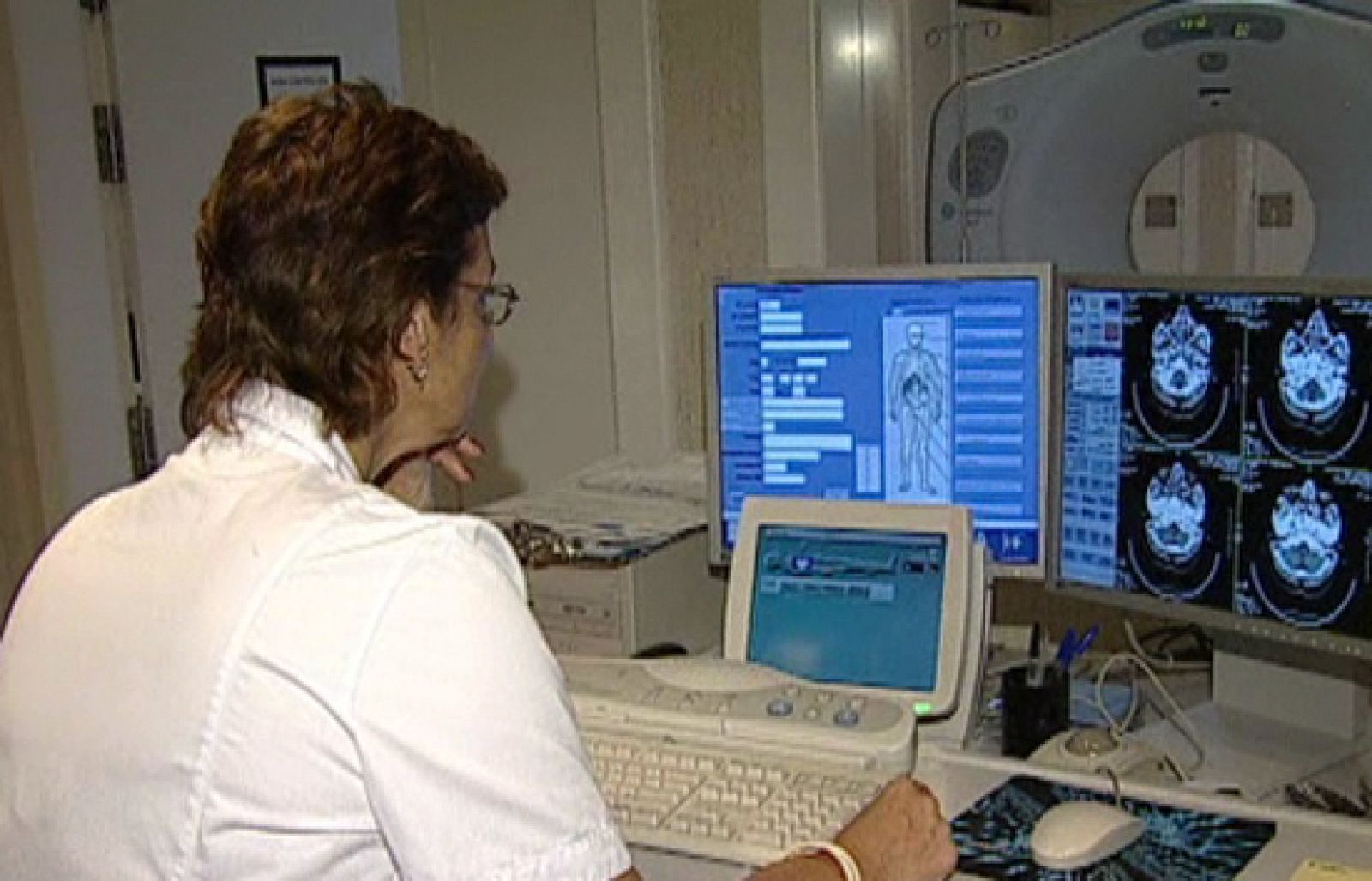 Gloria Prat es la endocrina que diagnosticó un posible tumor de hipófisis a una desconocida en el autobús - Ciencia y tecnología en Rtve.es | Ver
