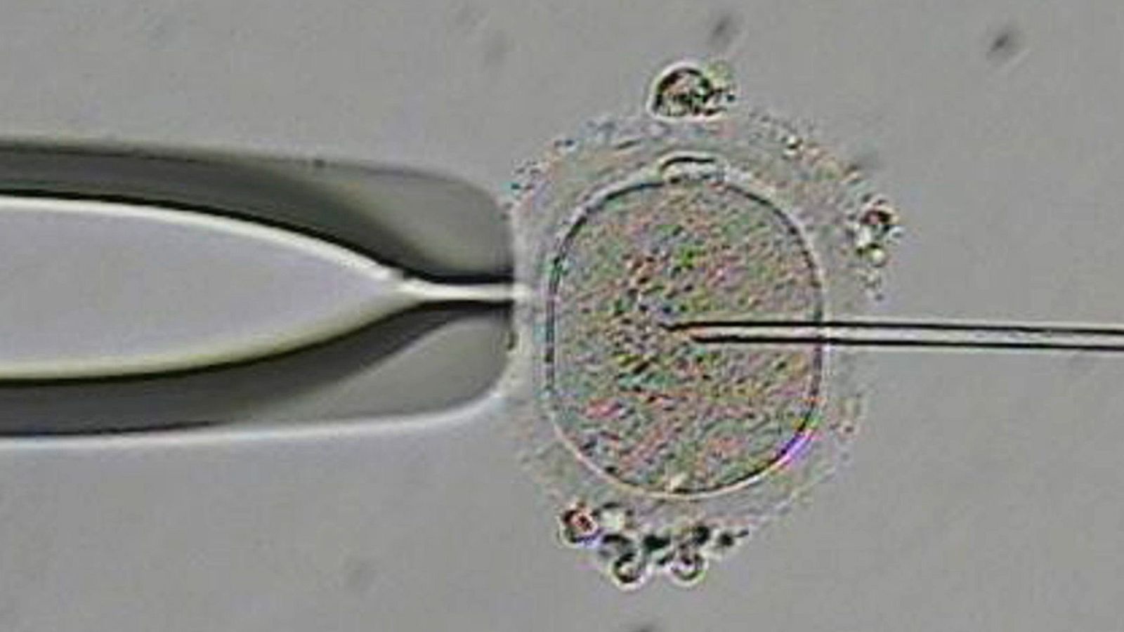 La noche temática - La lucha por la fertilidad - Ver ahora