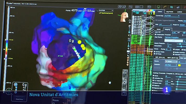 L'Hospital Vall d'Hebron impulsa una Unitat d'Arrítmies per al seu diagnòstic i tractament