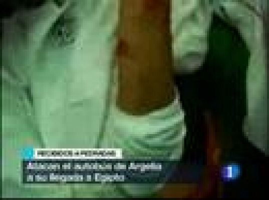 Grave agresión a Argelia