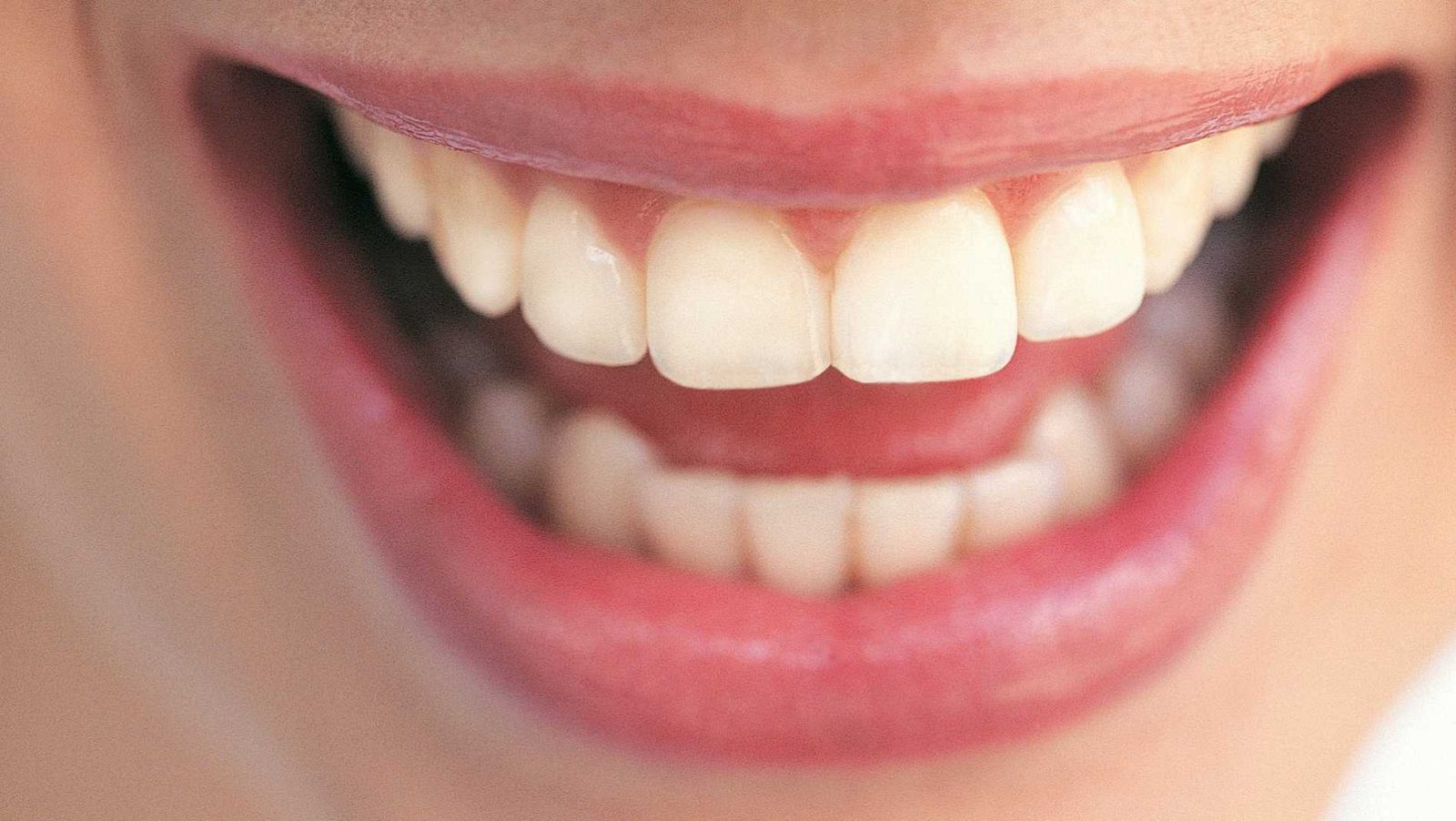 Consejos para aliviar el bruxismo