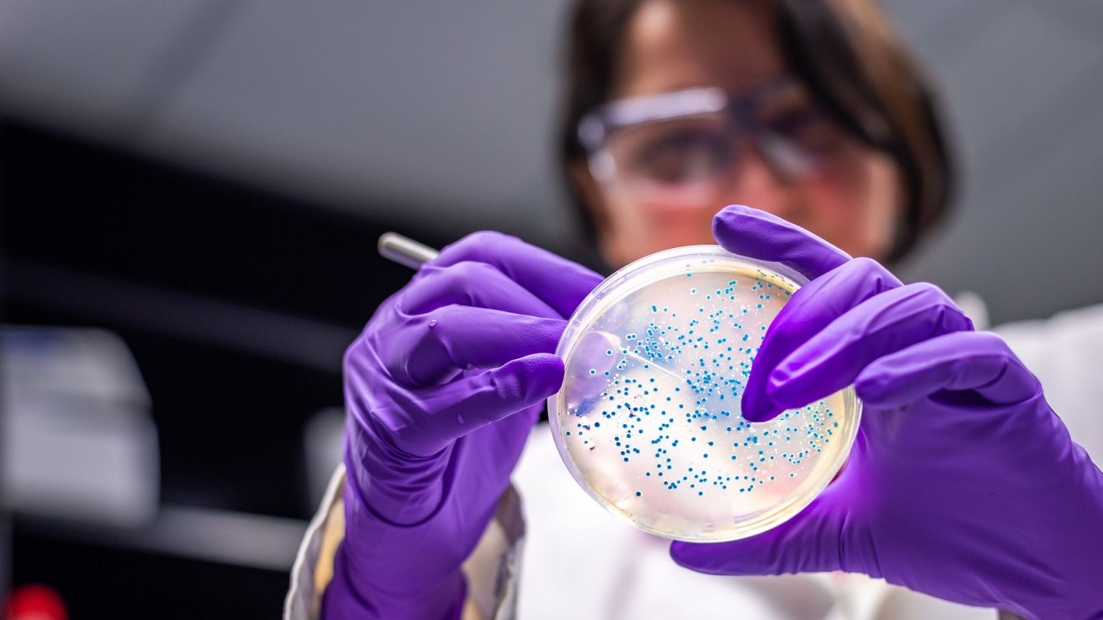 Las bacterias resistentes a los antibióticos causan ya más muertes al año que el sida