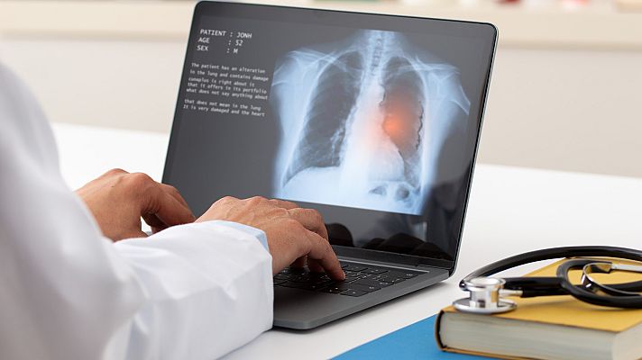 Telediario 2 - El mapa del cáncer: de la edad al entorno, los principales factores de riesgo en la península ibérica