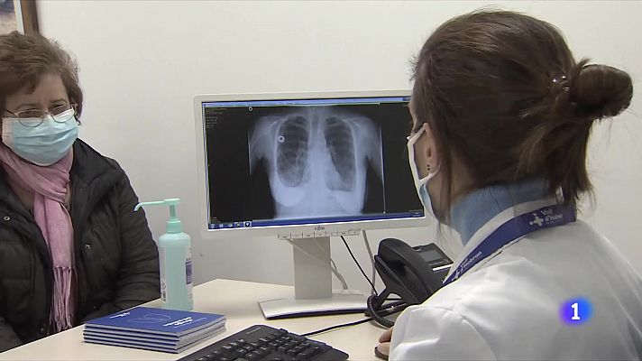 L'Informatiu - Trasplanten tres pulmons a una mateixa persona per primera vegada a Espanya