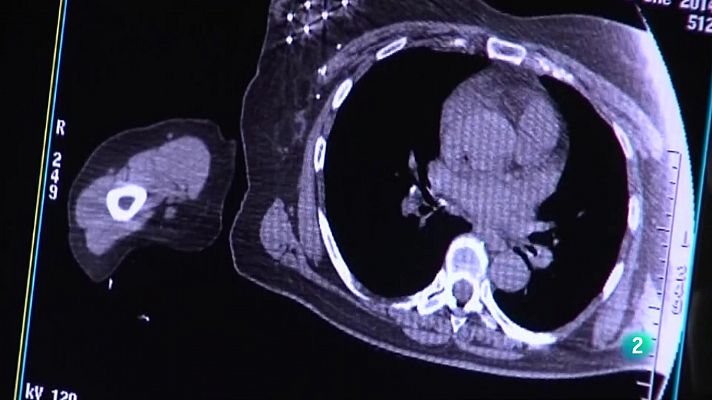 Telecanarias - Telecanarias 2 - 04/02/2022