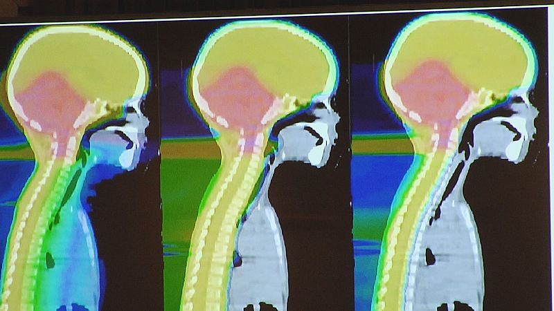 cáncer infantil en Navarra