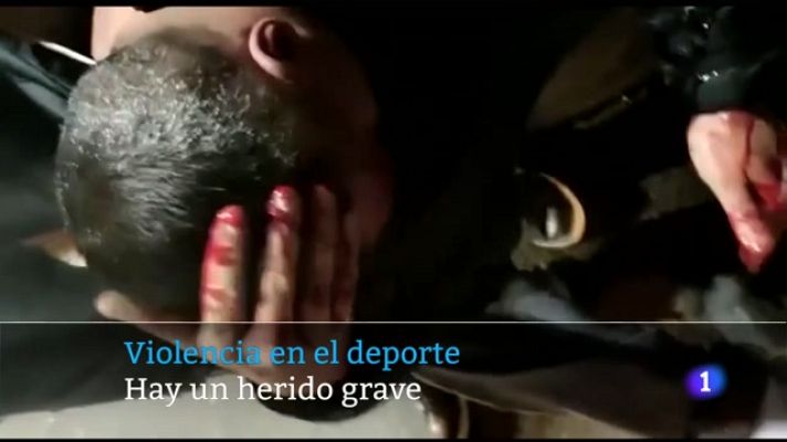 Telecanarias - Telecanarias - 18/02/2022