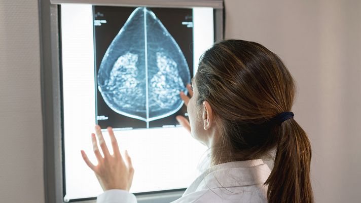 Un fármaco, eficaz contra la metástasis del cáncer de mama