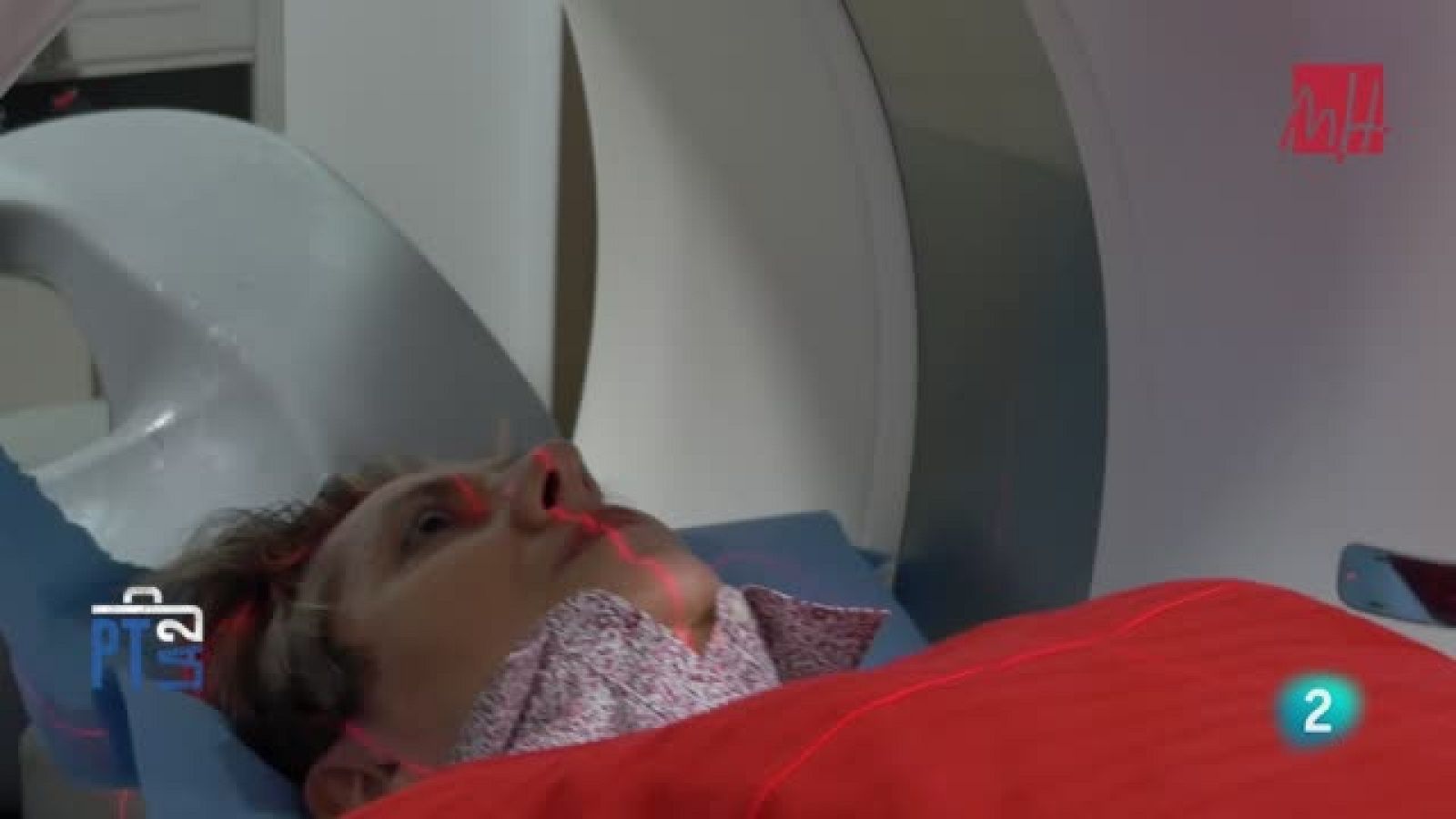 Implantes cerebrales para recuperar la visión