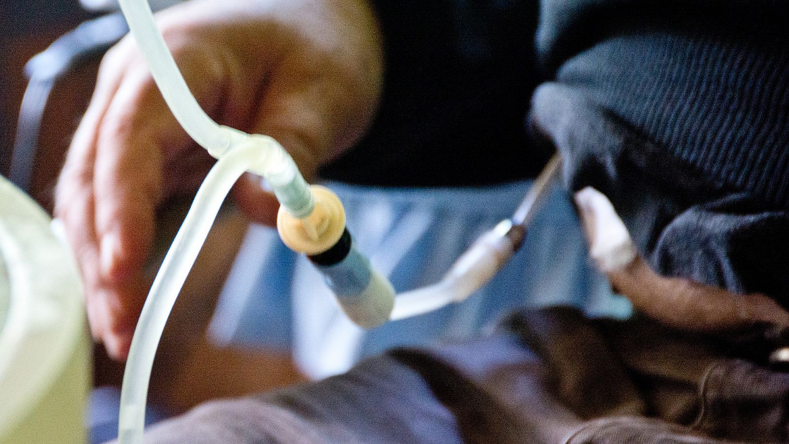 Enfermos de riñón piden ayudas para poder afrontar la subida de la luz | Ver