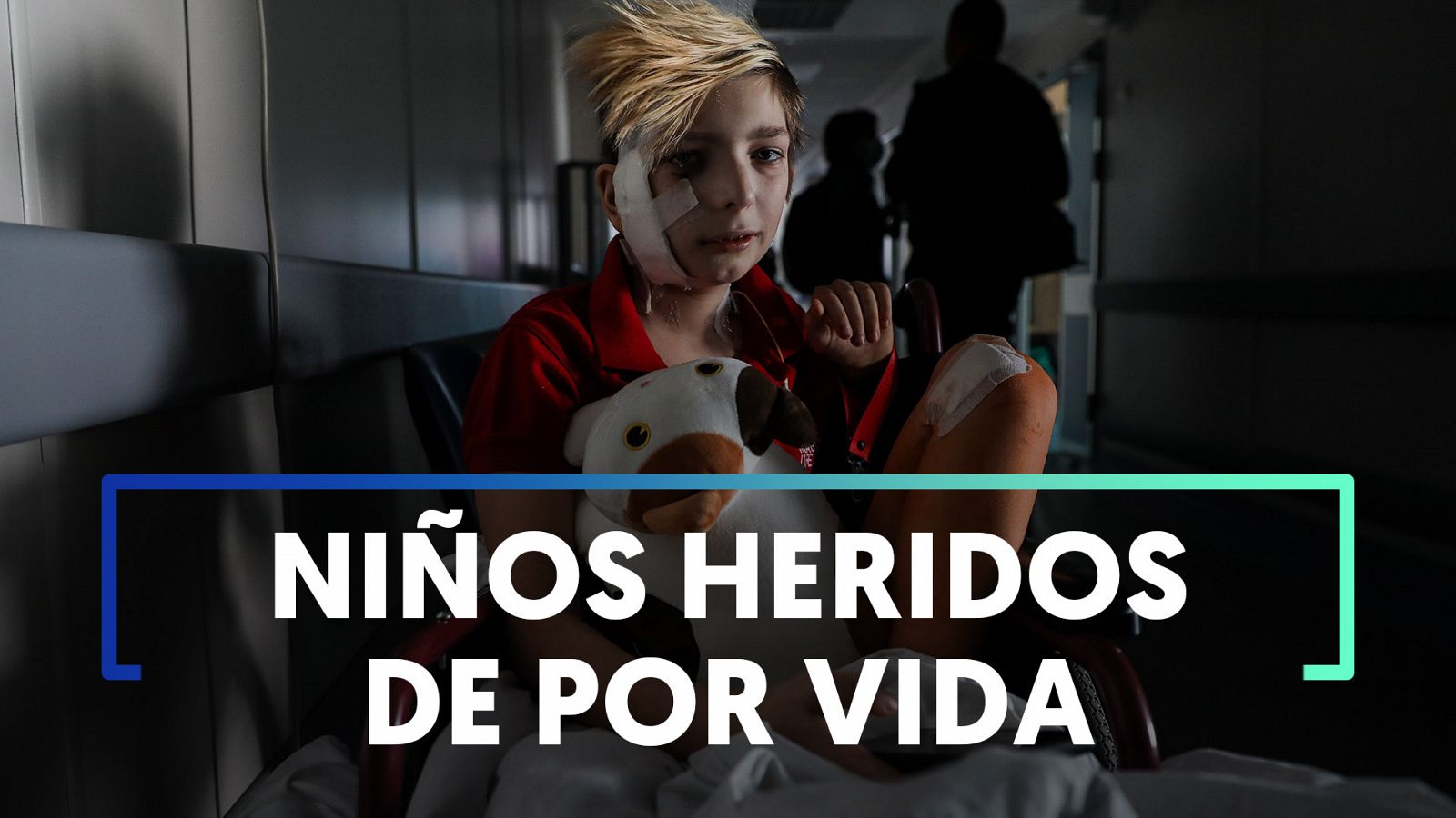 Guerra Ucrania: Las heridas físicas y emocionales de los niños