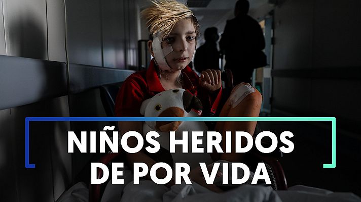 Modo Digital - Las heridas físicas y emocionales de los niños en Ucrania
