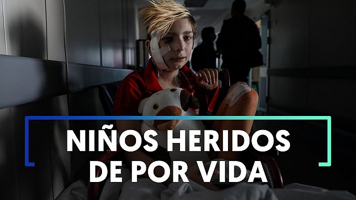 Las heridas físicas y emocionales de los niños en Ucrania