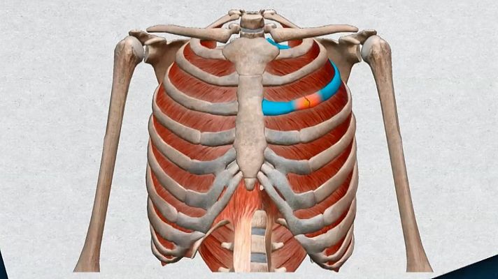  - El Dr. Pedro Ripoll analiza la fisura costal de Rafa Nadal