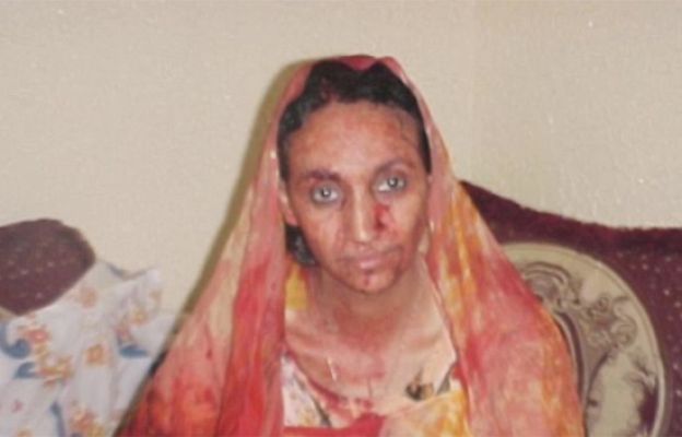  - Haidar cumple un mes en huelga