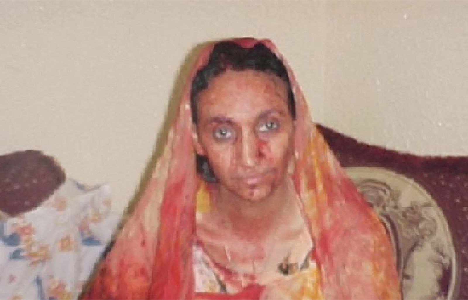 Aminatu Haidar fue torturada por la policía marroquí en 2005. Las imágenes, que entonces dieron la vuelta al mundo, ahora son recordadas cuando se cumple un mes de su huelga de hambre. 