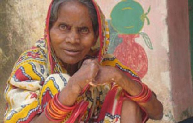 Pueblo de Dios - Lepra: del estigma a la esperanza