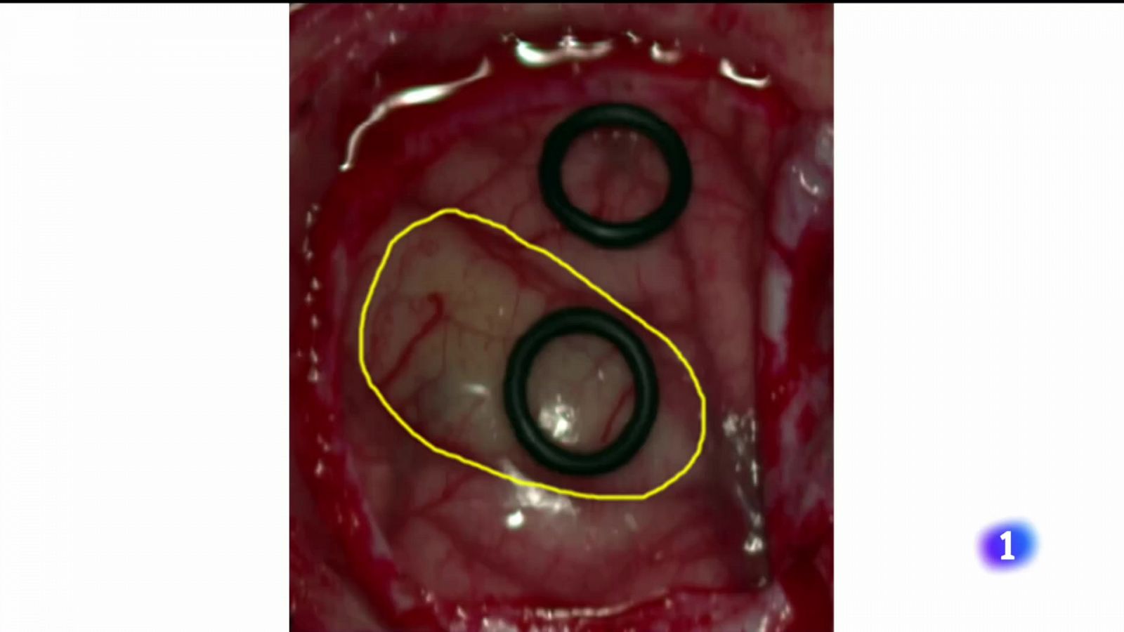 Imagen hiperespectral para el cáncer - Telecanarias | Ver