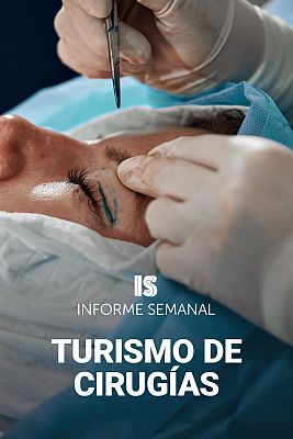 Informe Semanal - Turismo de cirugías