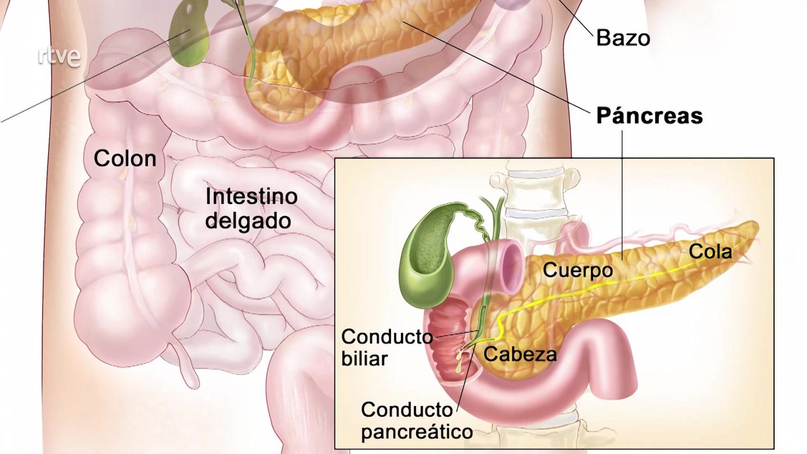 Universo sostenible: ¿Es la diabetes una enfermedad en auge?