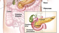 La aventura del saber - Universo sostenible: ¿Es la diabetes una enfermedad en auge?