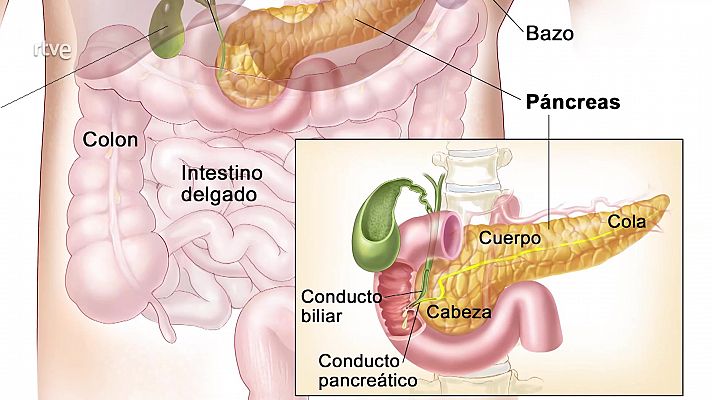 Universo sostenible: ¿Es la diabetes una enfermedad en auge?