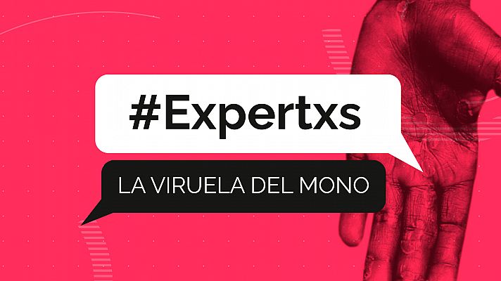 Viruela del mono y sus estigmas: ¿qué es, cómo se contagia?