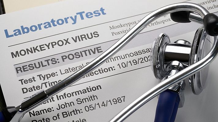 Crean un kit para detectar el virus de la viruela del mono