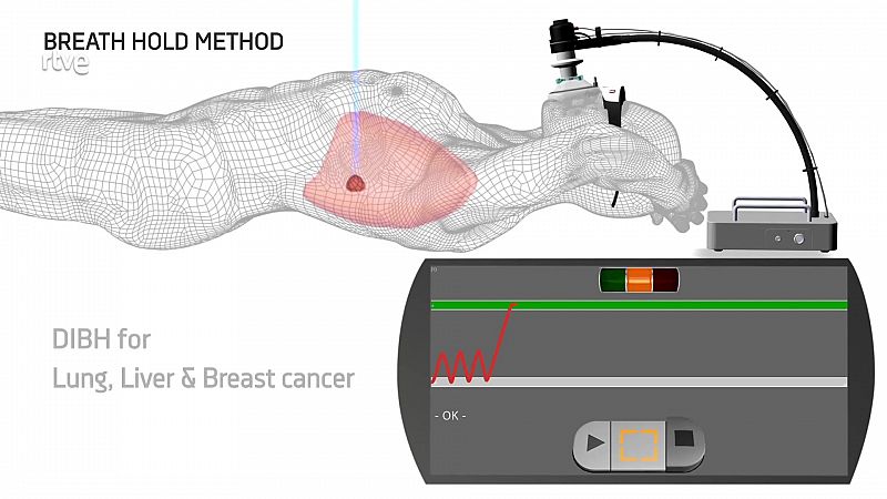 La aventura del saber - Los avances de los tratamientos de radioterapia - ver ahora