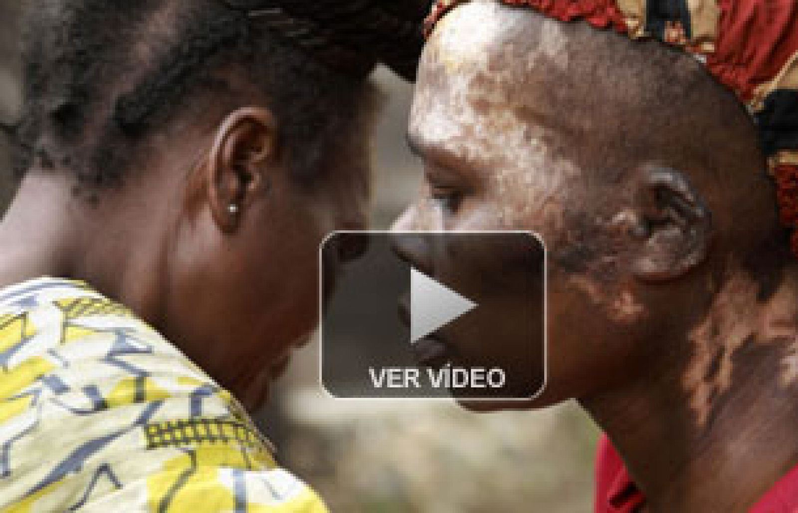 Las heridas de Françoise