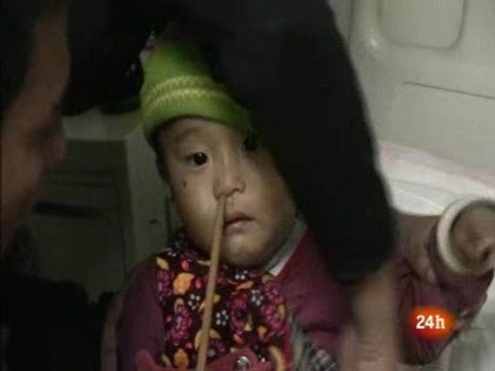 Un niño chino de cuatro años se mete un palillo accidentalmente por la nariz | Ver