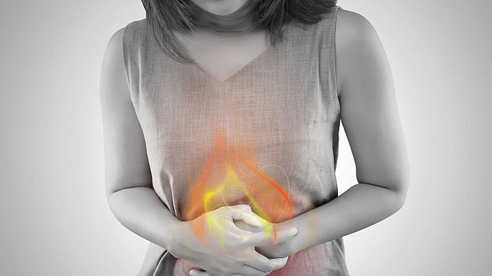 Saber vivir - ¿Cuál es el origen de la acidez estomacal?