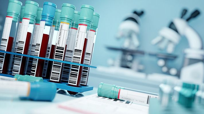 Informativo 24h - Una paciente con VIH logra controlar el virus sin medicación