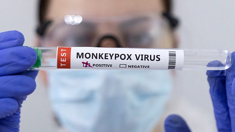 Confirmada la primera muerte por viruela del mono en España