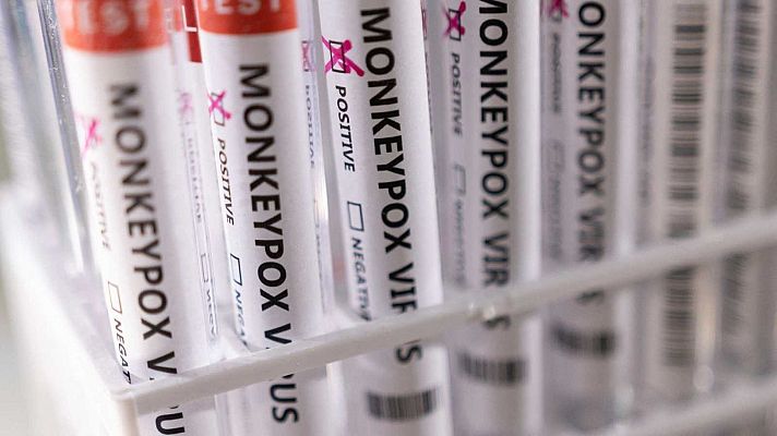 Segunda muerte en España relacionada con la viruela del mono