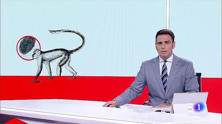 Informativo de Madrid - Viruela del mono 04/08/2022