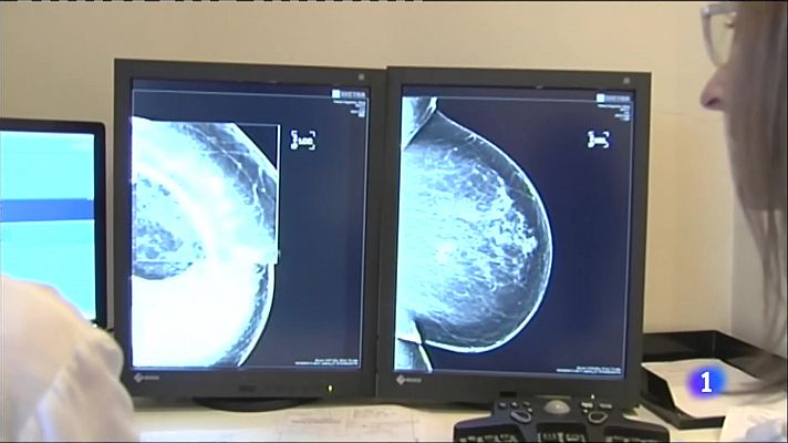 Un diagnòstic ràpid és clau per actuar contra el càncer de mama
