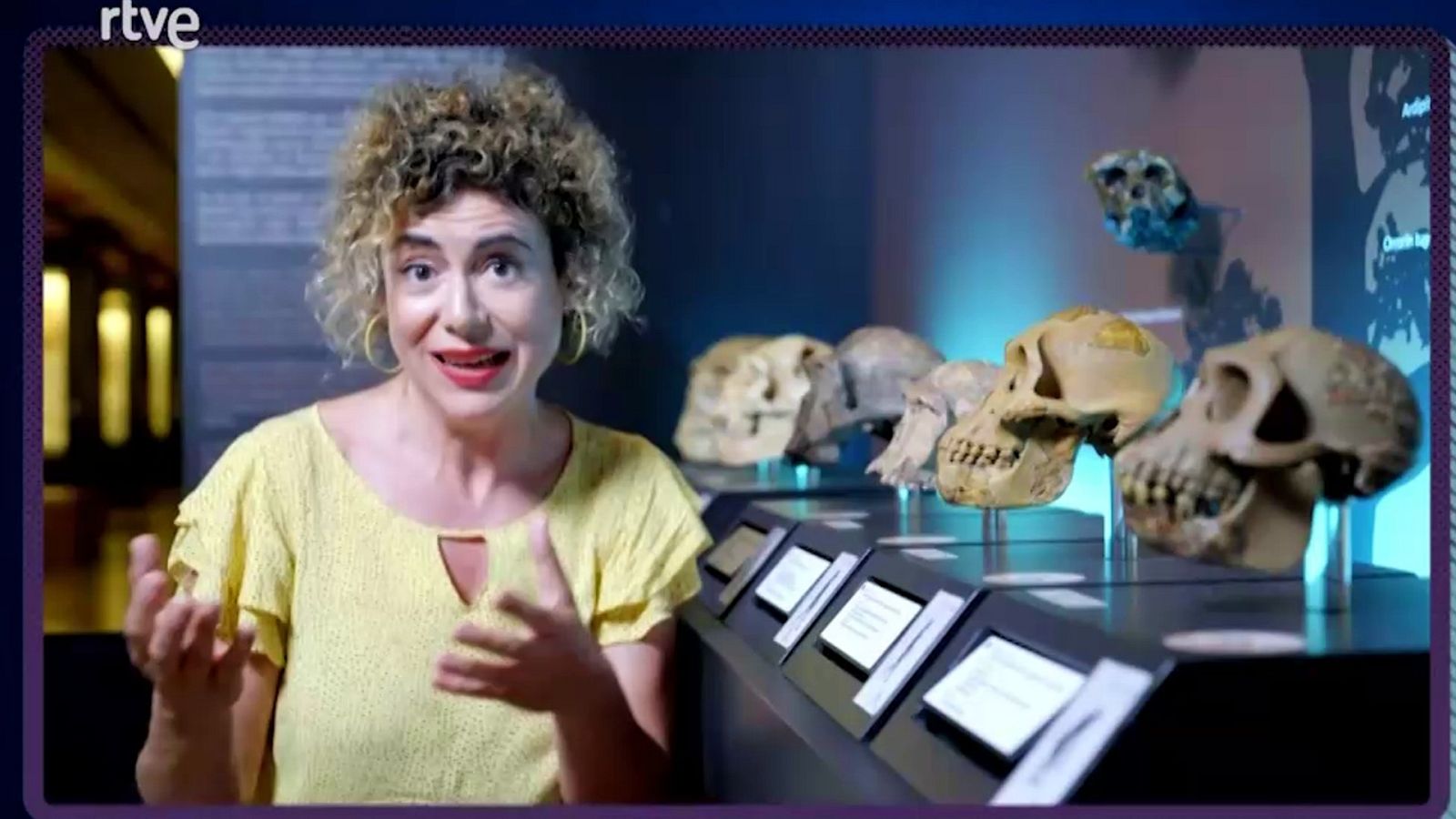 Mapi - ¿Por qué se nos ponen los pelos de punta? - Mapi | Ver