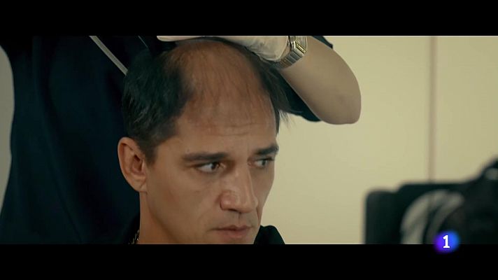 'Por los pelos', una divertida comedia sobre los viajes a Turquía para transplantes de pelo