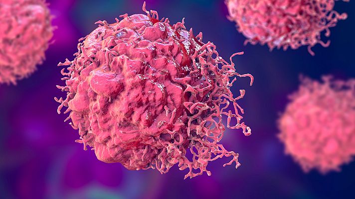 Telediario 2 - Casi la mitad de las muertes por cáncer están provocadas por factores de riesgo que se pueden prevenir