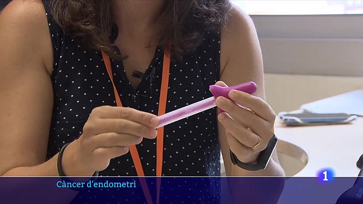 Un test semblant a un tampó detecta el 90 % dels càncers d'endometri
