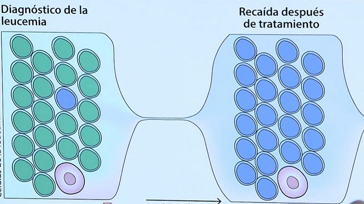 Telediario 2 - La evolución de la leucemia podría conocerse en el diagnóstico, según un estudio